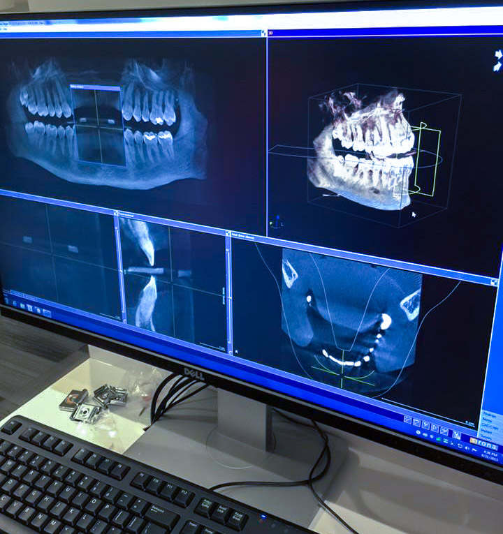 3d model of teeth