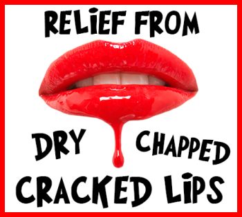 Calgary dentist, Dr. Clark Crawford and Dr. Nikla Reddy at Calgary Dental House, tells you how to relieve your dry, chapped, and cracked lips!