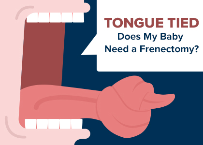 Calgary dentist, [DR. NAME] at Calgary Dental House, discusses different types of frenums, how they can cause problems for your baby’s mouth, and treatment with frenectomy.