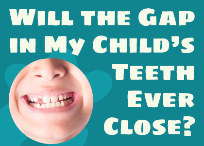 Calgary dentists Dr. Clark Crawford and Dr. Nikla Reddy of Calgary Dental House talks about potential causes and treatments for gapped teeth in children.