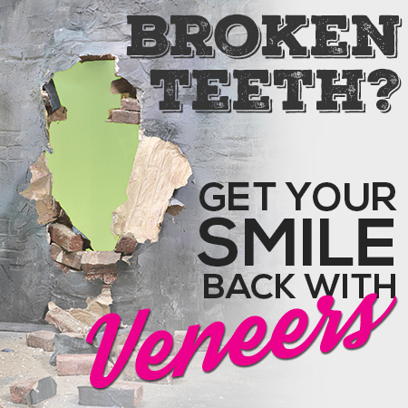 Broken teeth? Get your smile back with veneers