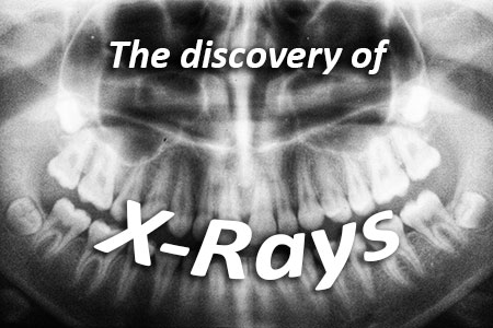 the discovery of x-rays