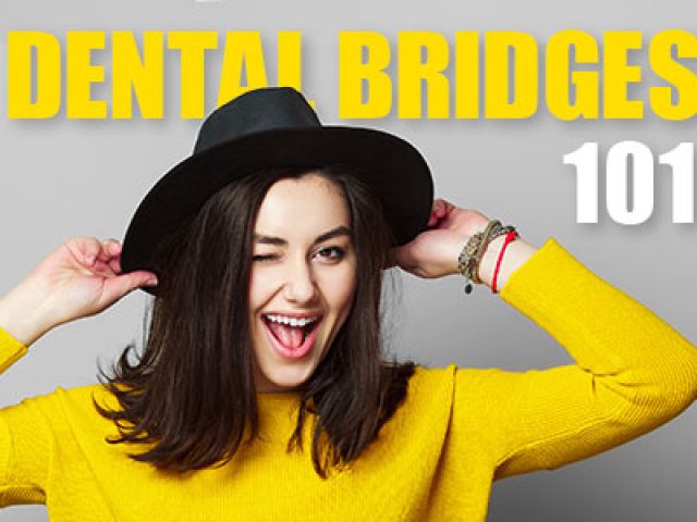 Dental Bridges 101 (featured image)