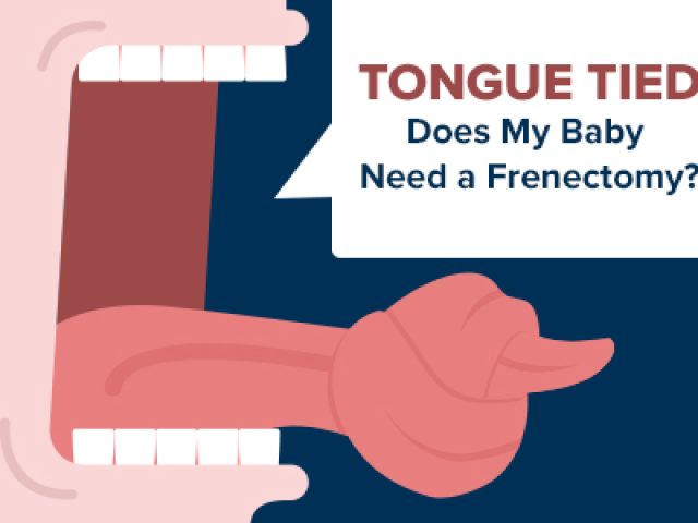 Tongue Tied: Does My Baby Need a Frenectomy? (featured image)