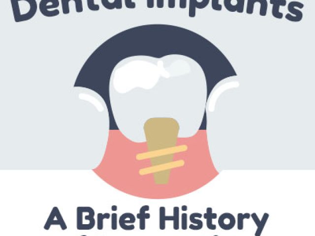 Dental Implants: A Brief History of Tooth Replacement Innovation (featured image)