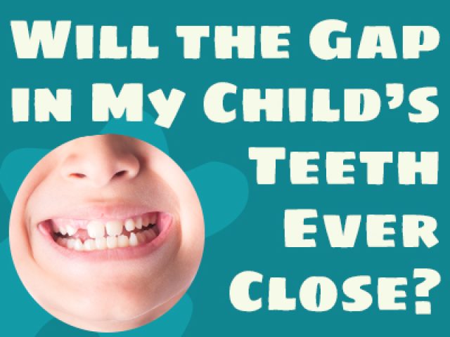 Will the Gap in My Child’s Teeth Ever Close? (featured image)