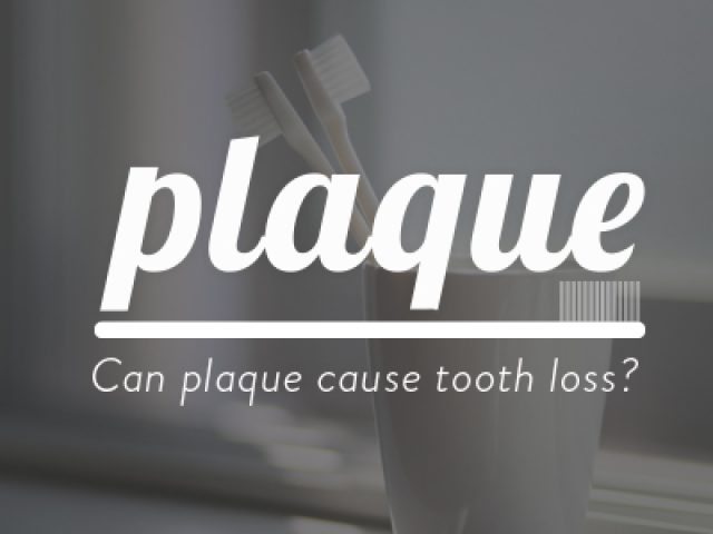 Can Plaque Cause Tooth Loss? (featured image)