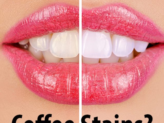 Are Your Teeth Safe from Coffee Stains? (featured image)